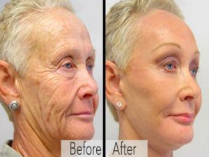 skin-transformation